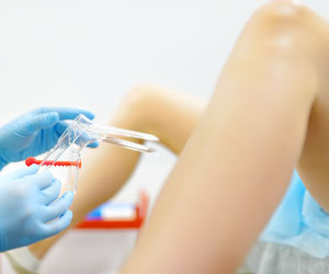 ПАП-тест: определение, норма и для чего используют