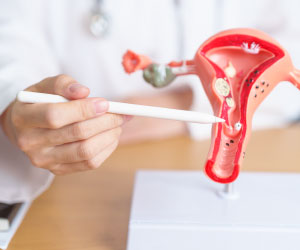 Що таке ерозія шийки матки?