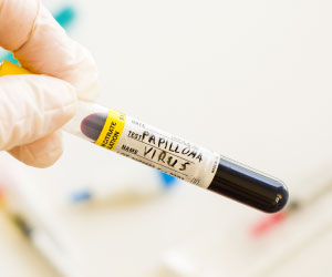 Вирус папилломы человека у мужчин и женщин