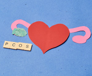 Полікістоз яєчників: симптоми, лікування СПКЯ