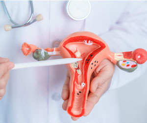 Міома матки: лікування, причини, симптоми