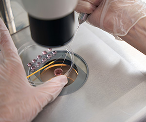 Когда лучше переносить эмбрион — на третий или на пятый день?