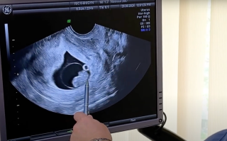 История прохождения бесплатного ЭКО по государственной программе медицинских гарантий