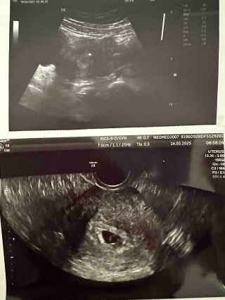 Коли життя дарує ще один шанс: історія другого материнства через державну програму