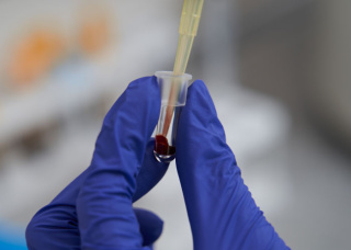 Что должна знать резус-отрицательная женщина?