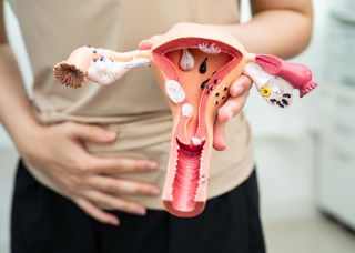 Параоваріальна кіста яєчника